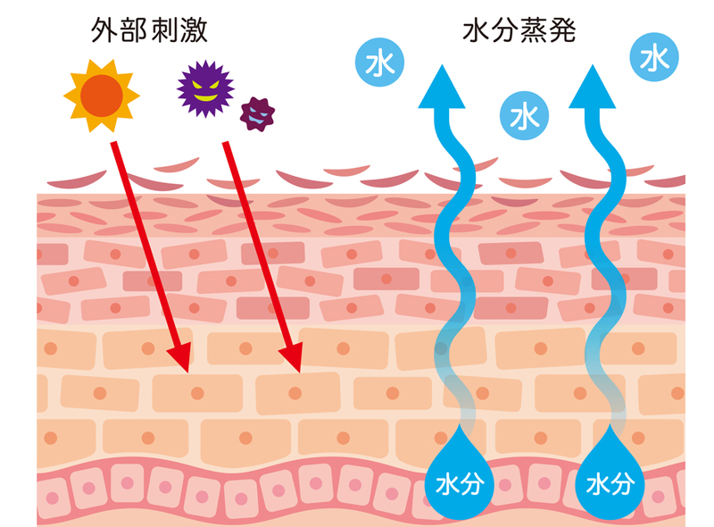 アトピー性皮膚炎になった皮膚の断面図。バリア機能が低下した皮膚では、外部刺激(紫外線やアレルゲン)が侵入しやすく、同時に水分が蒸発して失われていく様子を示している。